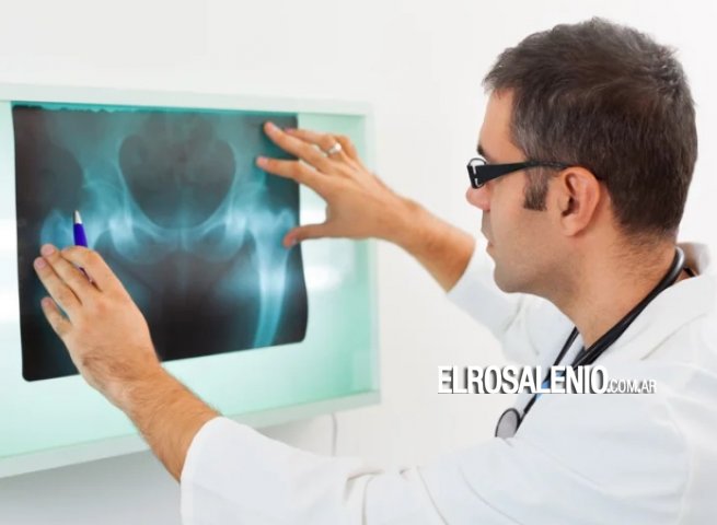 Osteoporosis, la enfermedad silenciosa que causa 90 fracturas de cadera por día en Argentina
