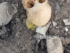 Hallaron restos óseos humanos en el basural